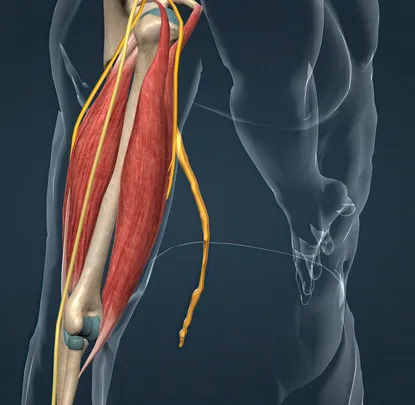 medical cannabis for neurogenic pain